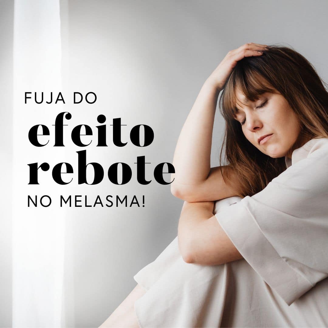 Efeito rebote no melasma