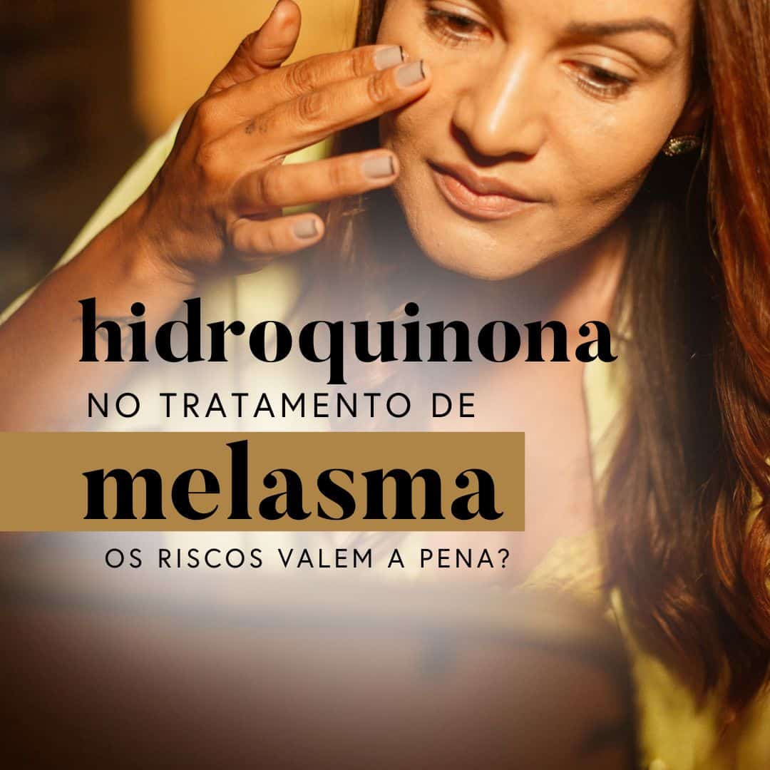 Hidroquinona no tratamento de melasma