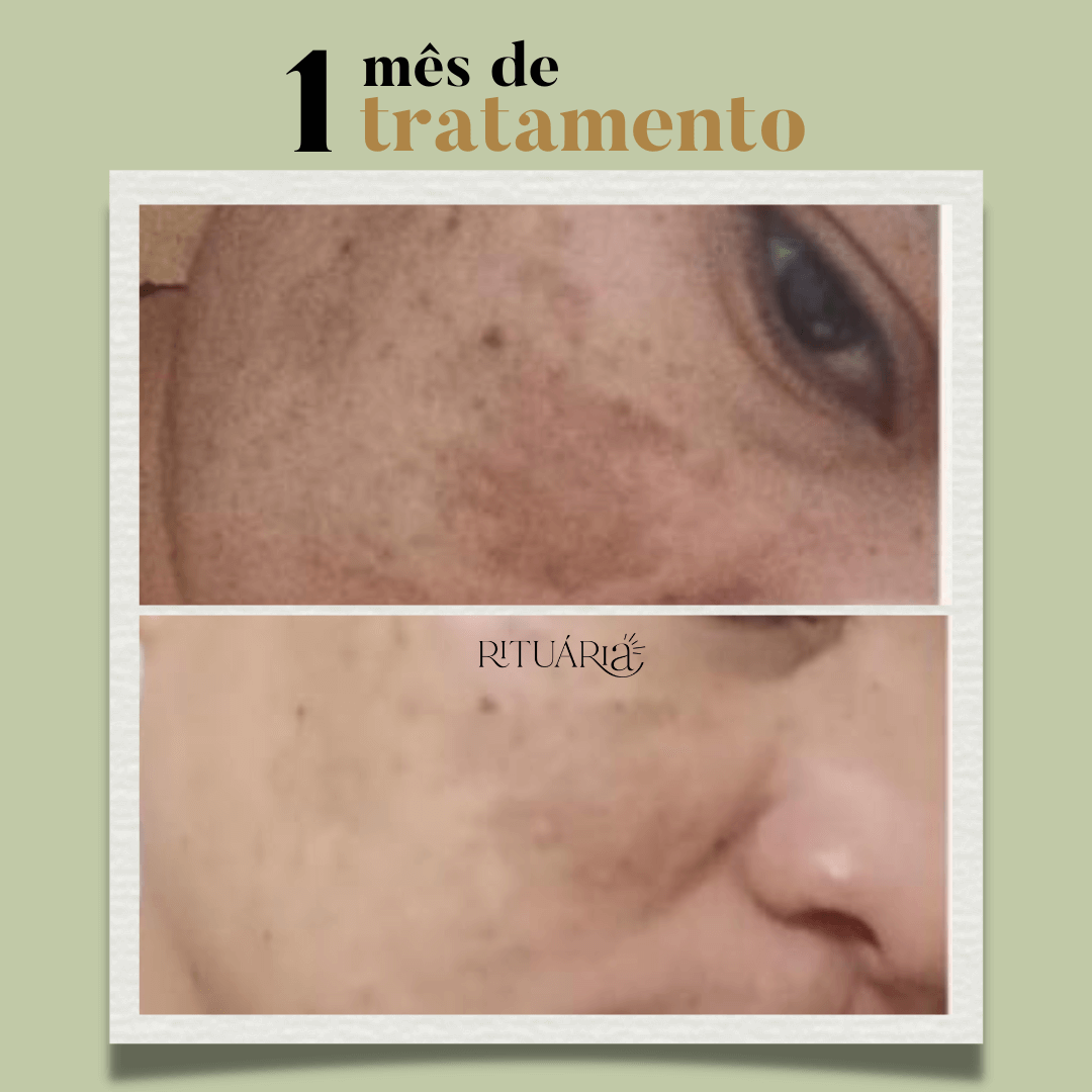 Uniformizadora + Hidratante + Antioxidante + Micelar