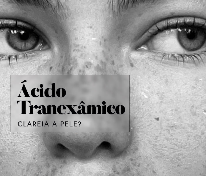 Ácido Tranexâmico: Como Ele Funciona para Uniformizar o Tom da Pele