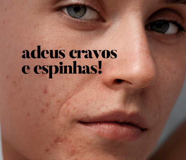 Como acabar com cravos e espinhas de forma eficaz?