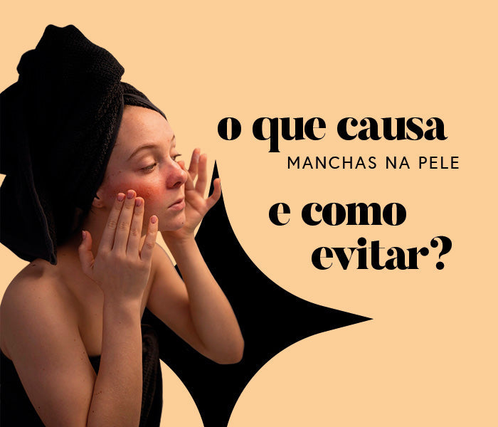 O que causa manchas na pele e como evitar?