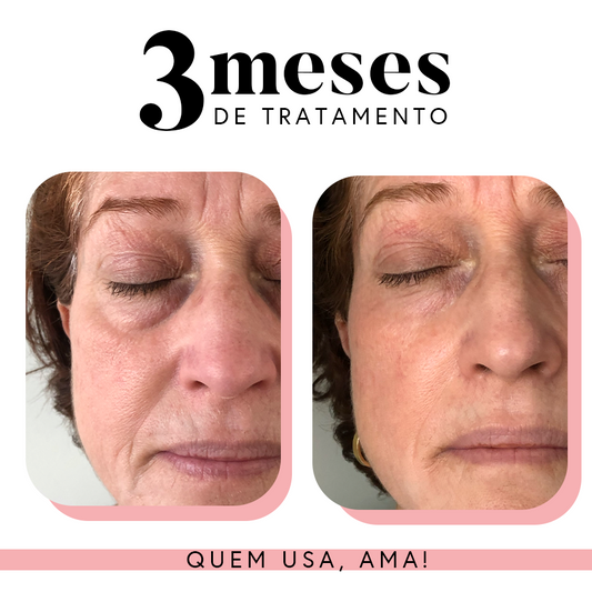 Ritual da Pele Renovada: Renovadora + Rosa Mosqueta