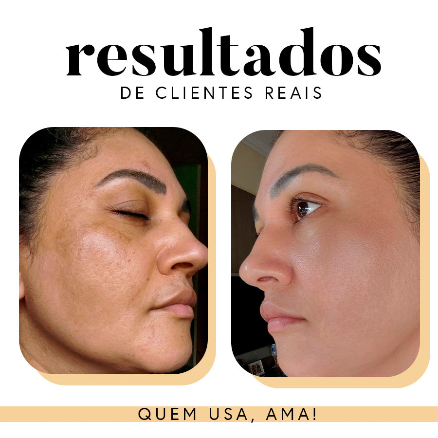 Fórmula Antioxi Nutri - Protetor Solar Oral - 30 cápsulas