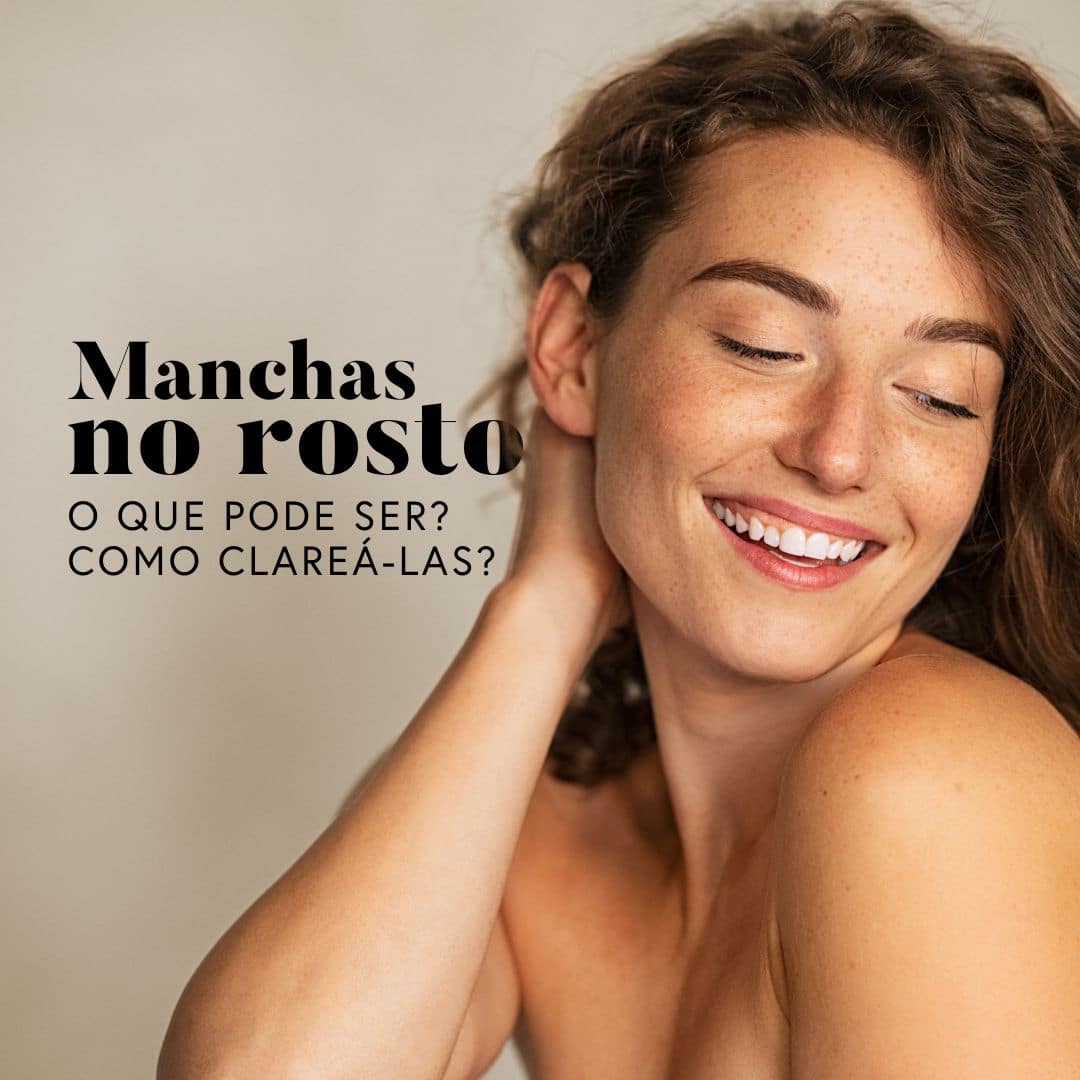 manchas no rosto será que é melasma