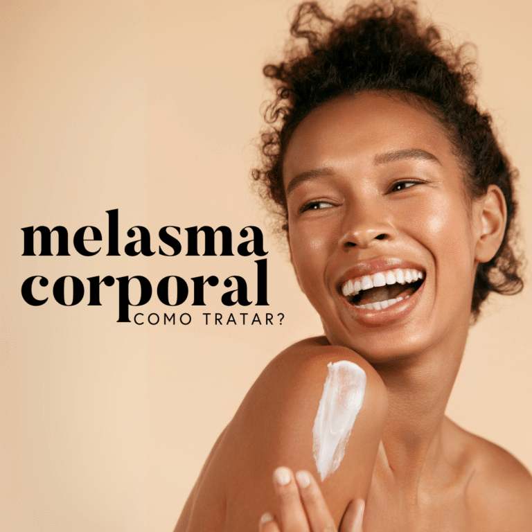 melasma no corpo