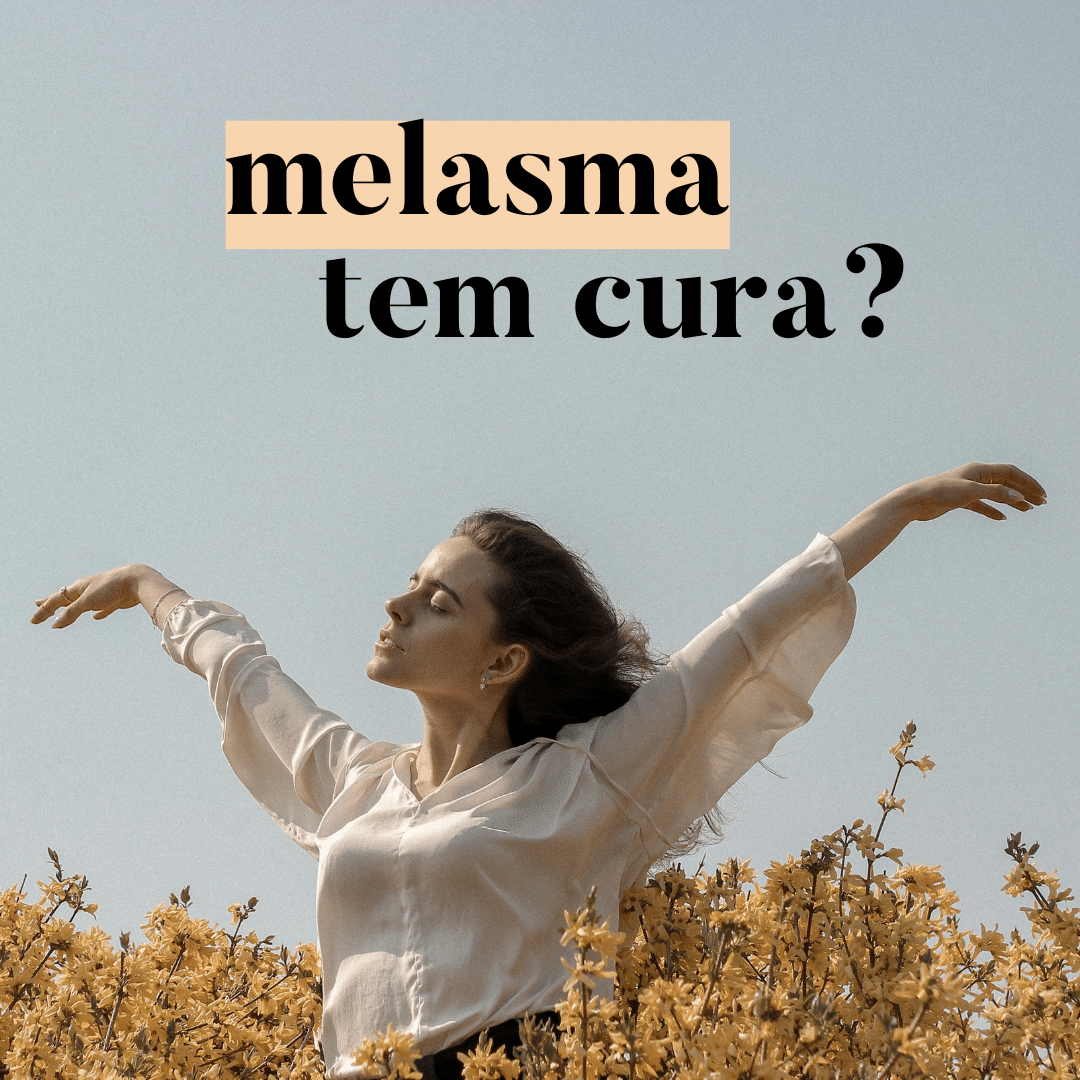 melasma tem cura