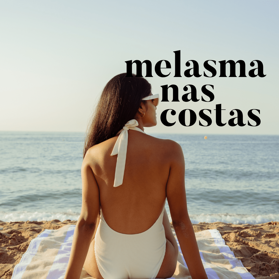 melasma nas costas