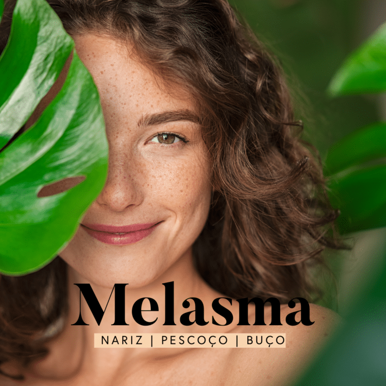 melasma no nariz